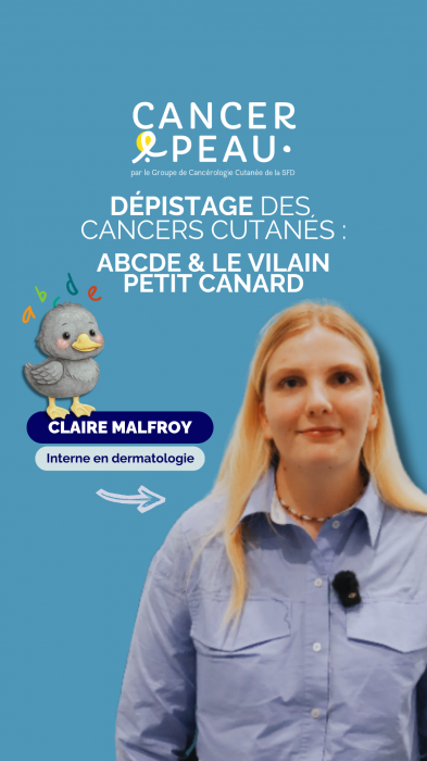 Règle du vilain petit canard