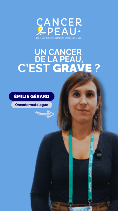 Faut-il se faire dépister des cancers de la peau régulièrement ?