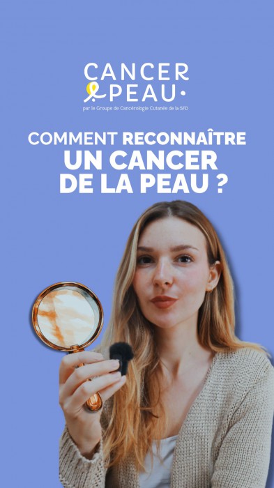 Quand consulter pour sa peau ?